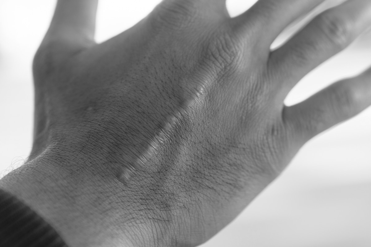 A Close Up Of A Hand