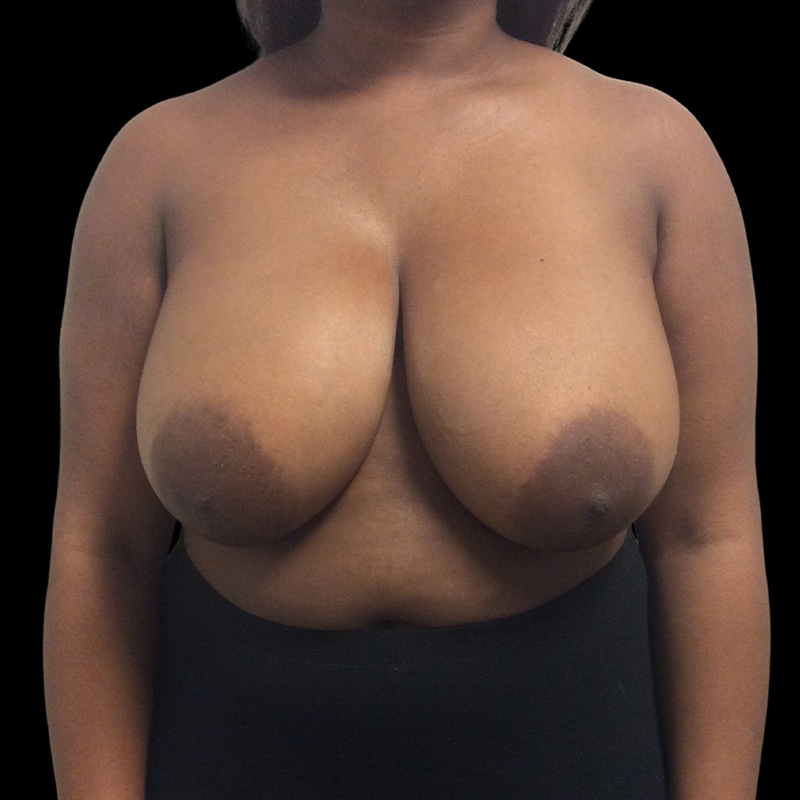 A Close Up Of A Person